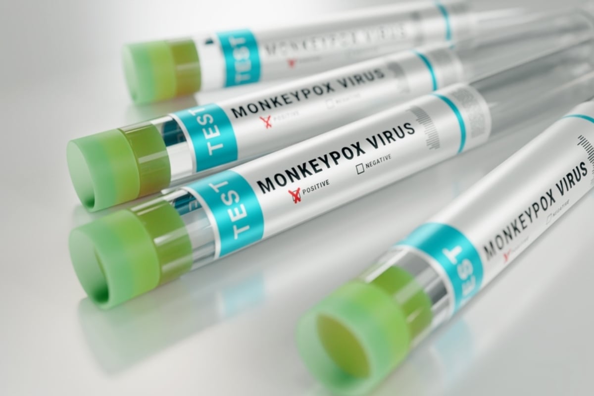 Virus del mono síntomas, Noticia, Brote, Salud, Enfermedad, Impacto