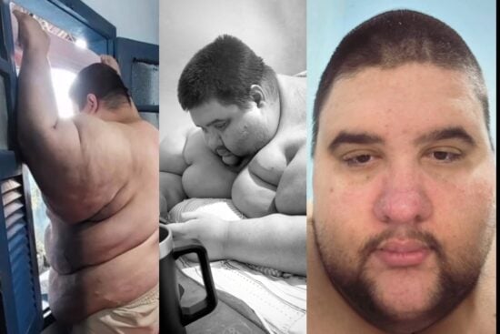 Brazilian influencer dies after fighting obesity
