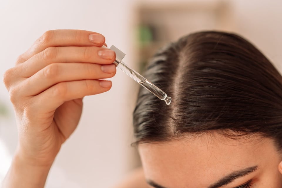 minoxidil para el cabello