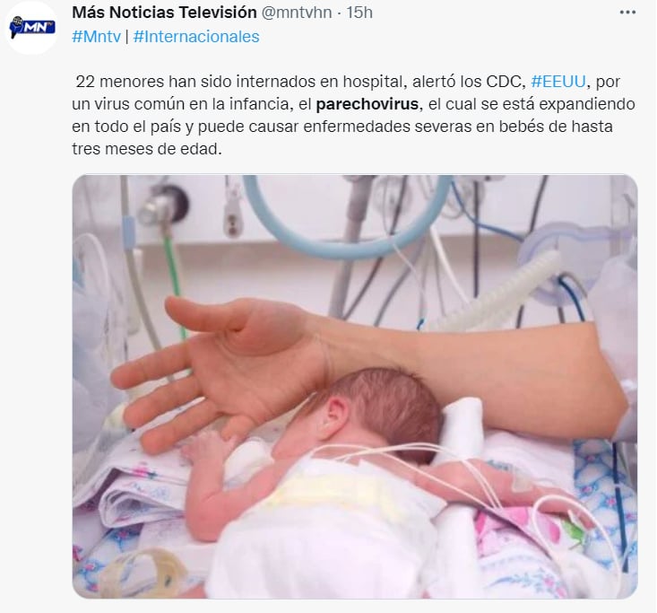 Babies hospitalized for parechovirus: What symptoms did they present?