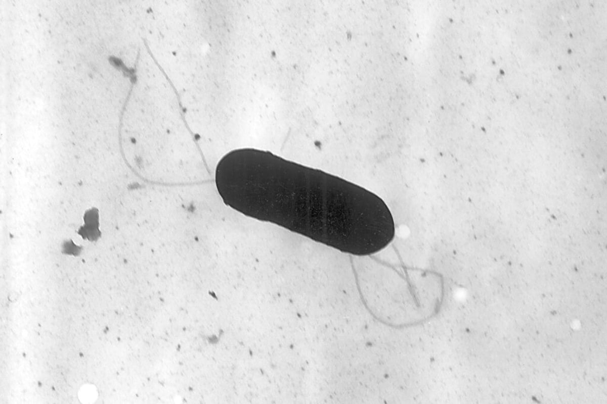 brote de listeriosis