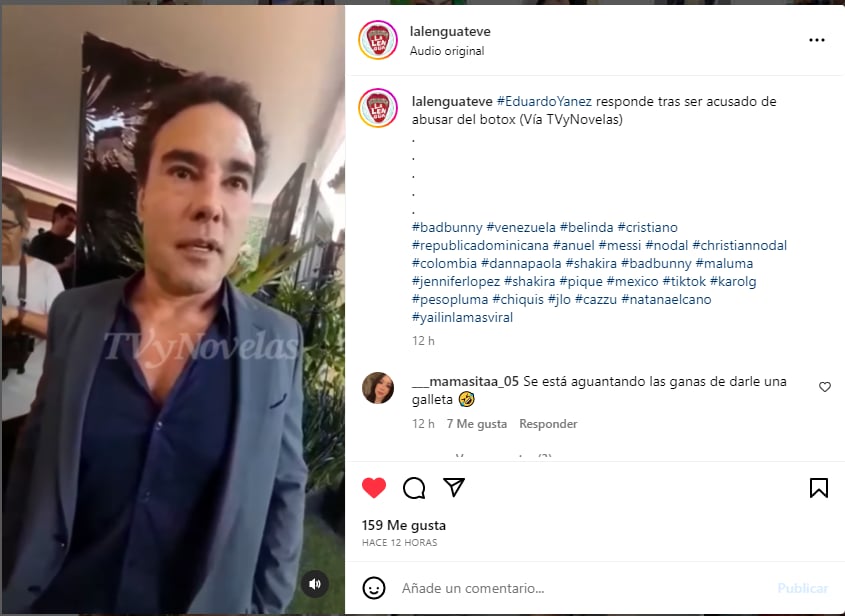 The leading man of soap operas Eduardo Yáñez is criticized for his appearance