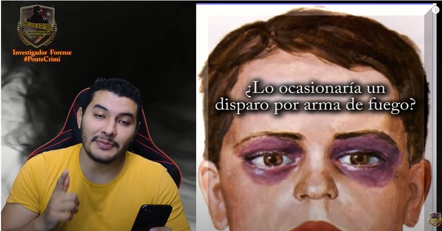 Análisis autopsia Valentín EIizalde