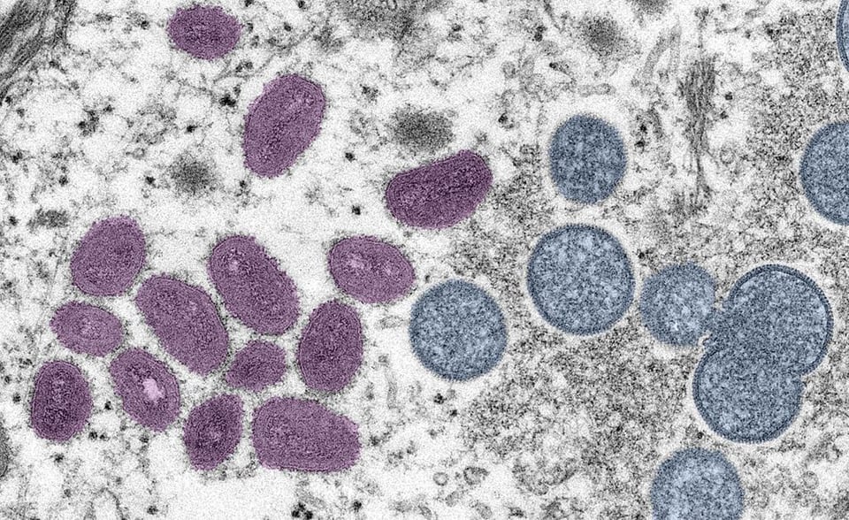 Norovirus Reaches Record Levels