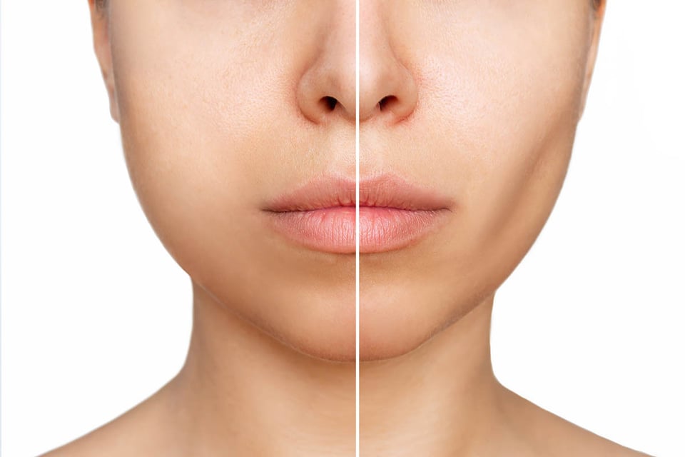 risks, recovery, face, surgery, woman