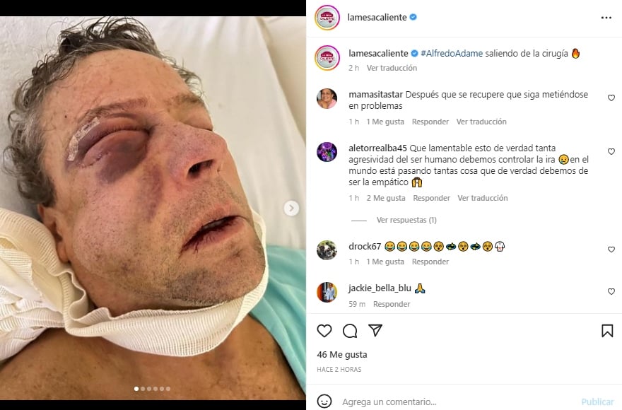 Alfredo Adame tras su cirugía