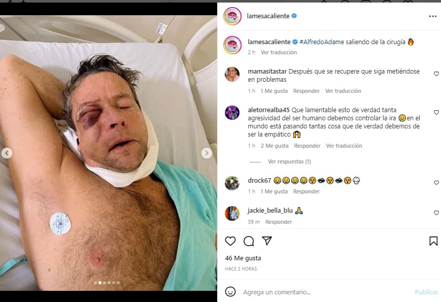 Alfredo Adame tras su cirugía