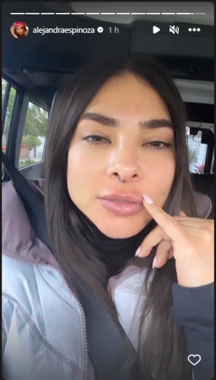 Alejandra Espinoza shows her disfigured face