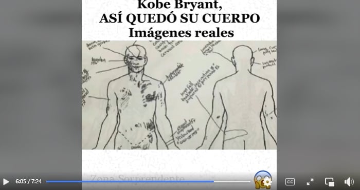 Cuerpo, imágenes reales, restos, accidente, aéreo