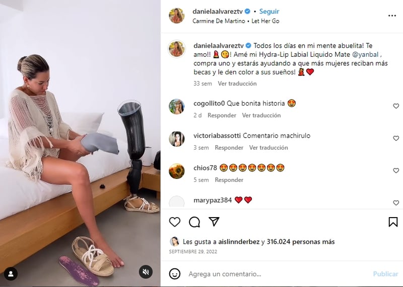 Daniela Álvarez was bitten by an animal
