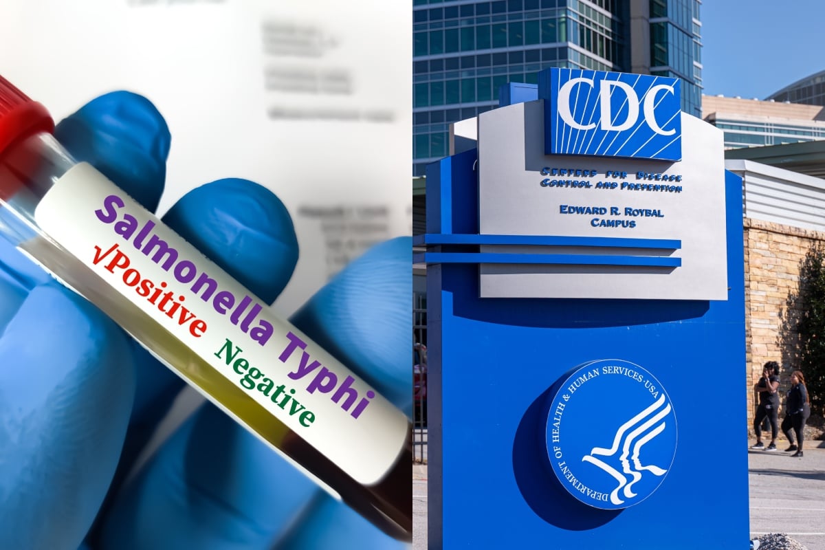 CDC investigates worrying Salmonella outbreak connected to backyard chickens