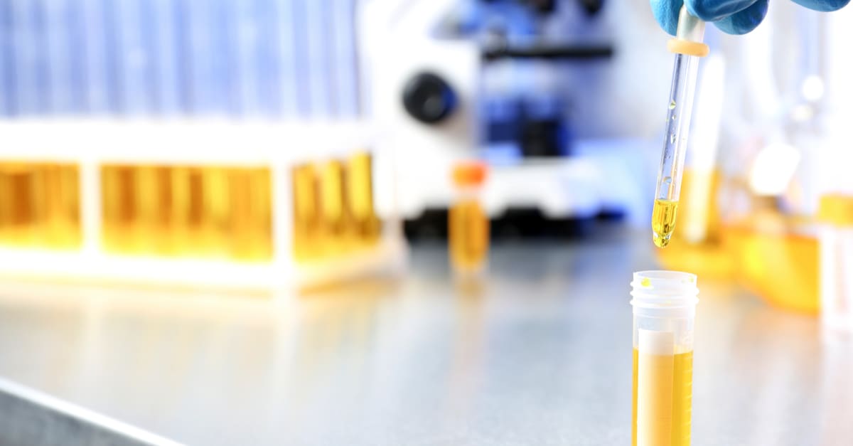 10 Things You Can Do with Your Own Urine