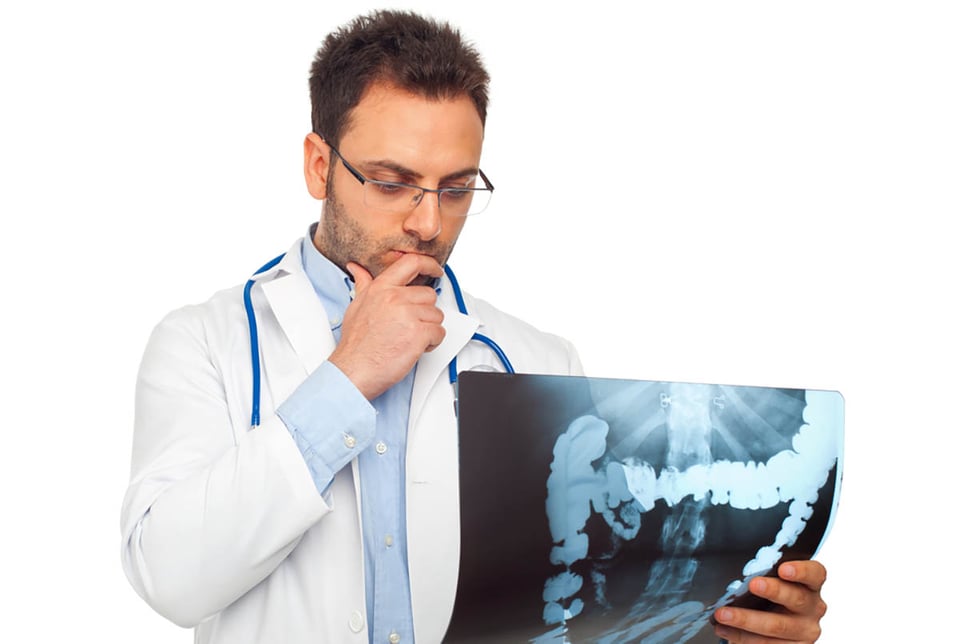doctor, x-ray, colon cancer, health, disease