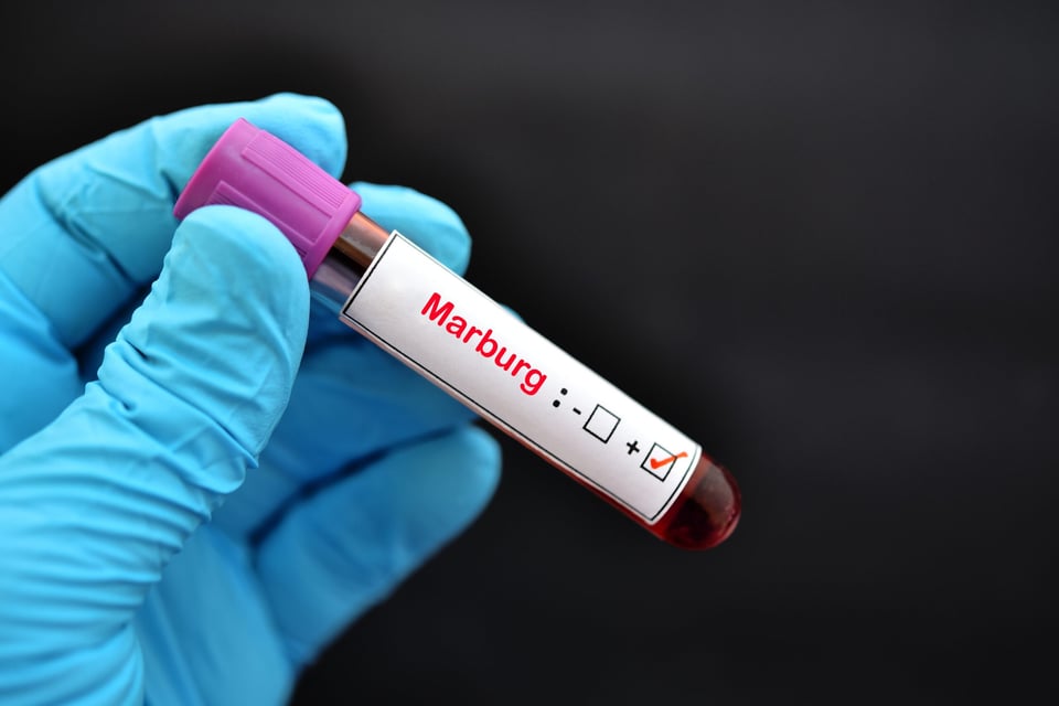 CDC issues Marburg virus alert in US after outbreaks in Africa