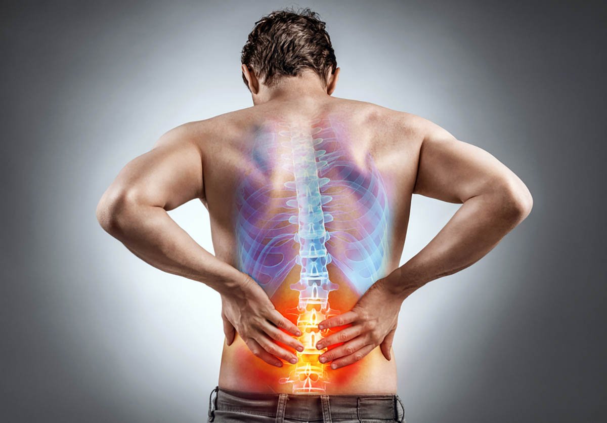 Remedios dolor de espalda, dolor de espalda, remedios, hombre, reprimiendo, médico-back pain, remedies, man, holding back, medical